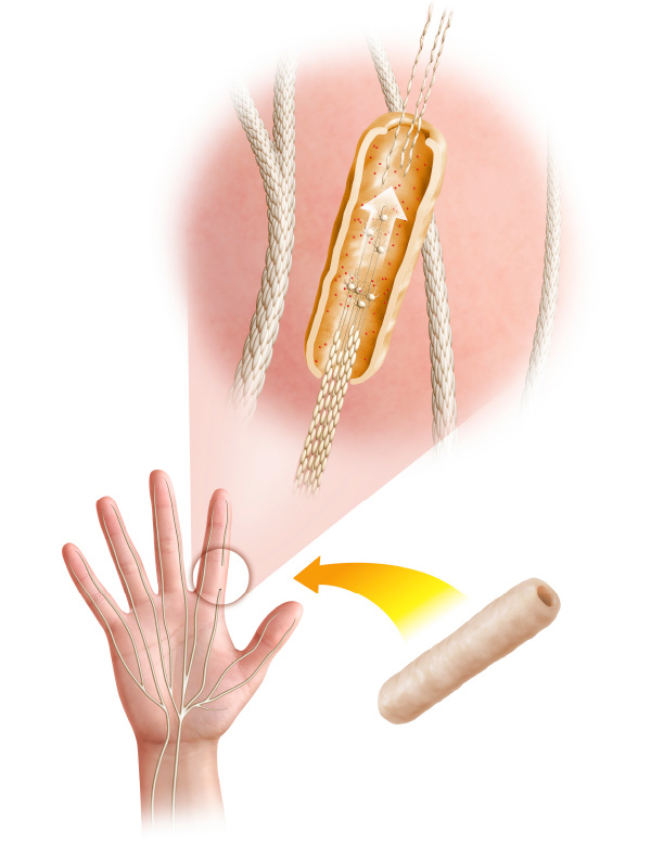 Nerve Regeneration